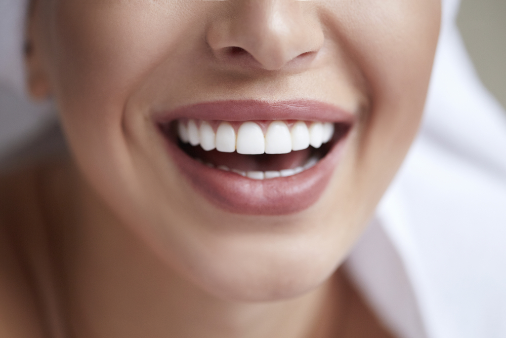 Invisalign